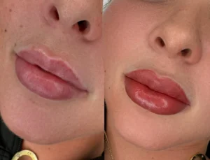 Lip Blush before and after